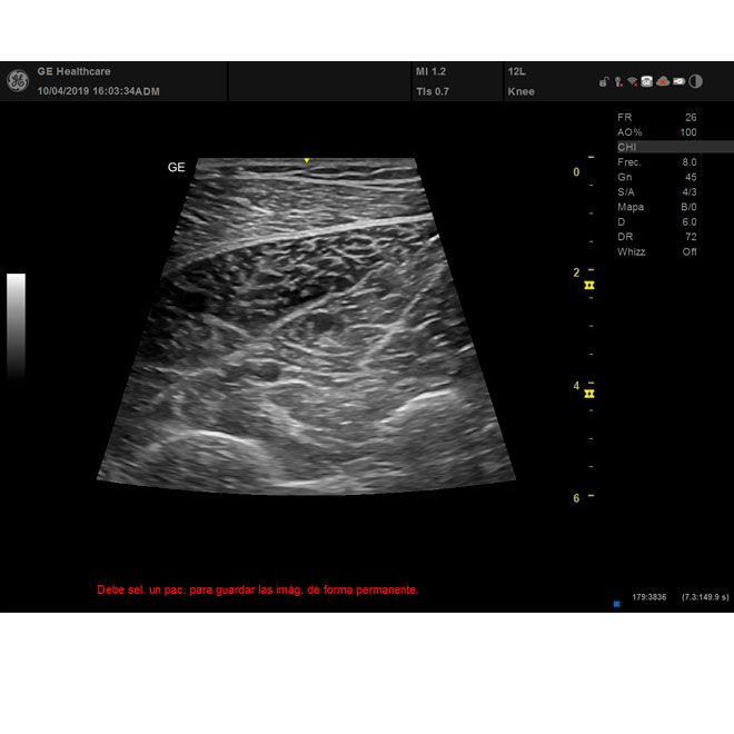 ECÓGRAFO VERSANA PREMIER - Imagen 3