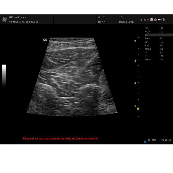 ECÓGRAFO VERSANA PREMIER - Imagen 2