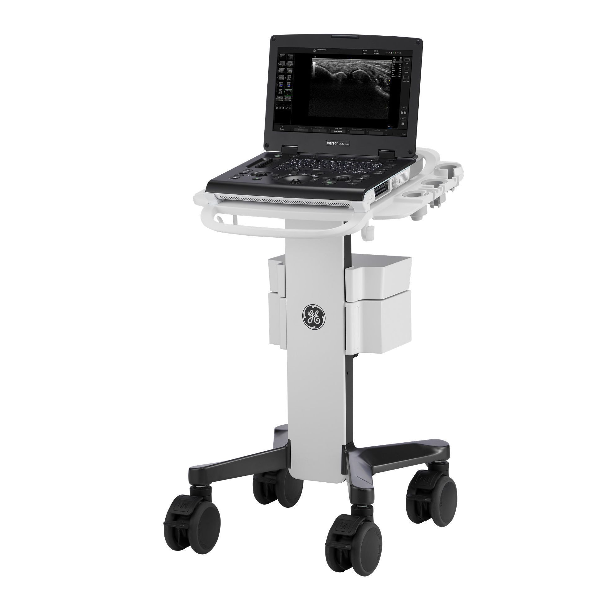 ECÓGRAFO VERSANA ACTIVE