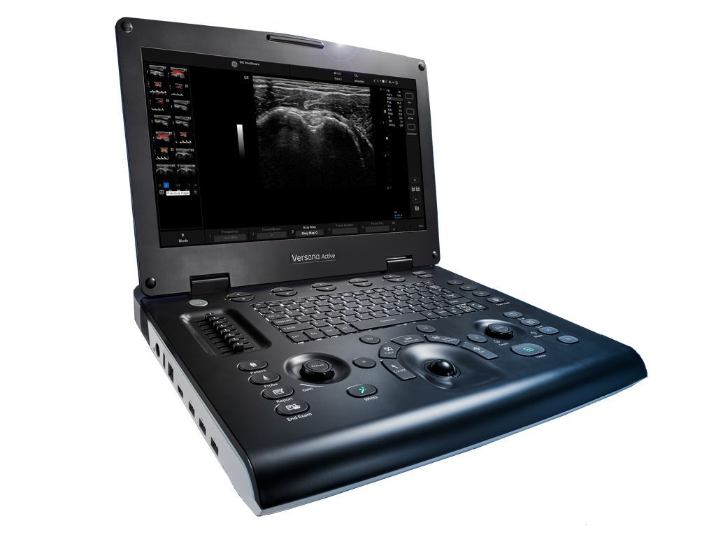ECÓGRAFO VERSANA ACTIVE - Imagen 2