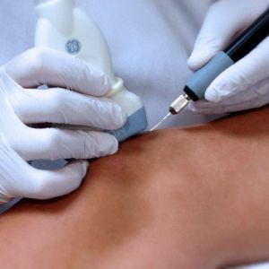 electrolisis