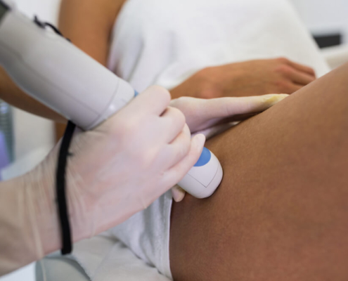 fisioterapia invasiva